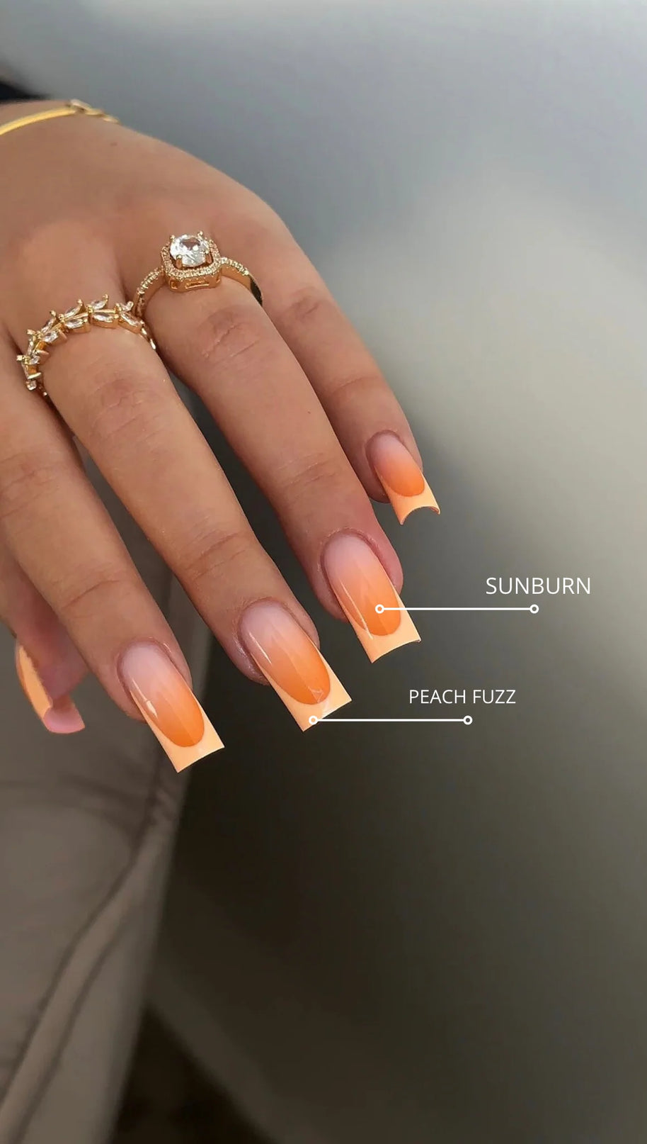 Sunburn